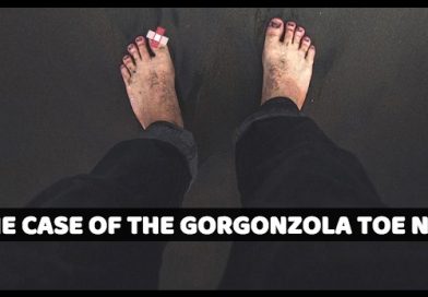 The Case of the Gorgonzola Toe Nail